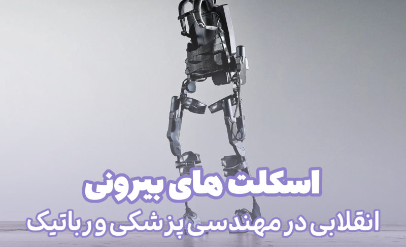AI (11)